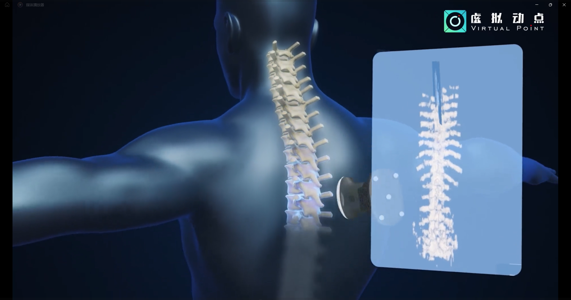 豪运国际welcome·虚拟动点OptiTrack开创3D超声成像在脊柱诊断中的应用